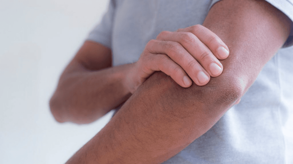 Image representing the word: arm